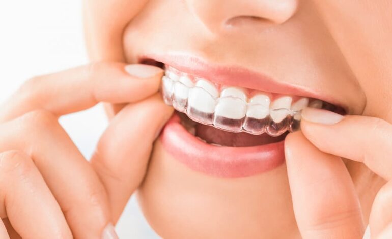  Transform Your Smile with Smiles and Smiles: Cutting-Edge Dental Care and Unbeatable Offers